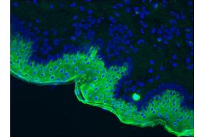 Image no. 2 for anti-Keratin 10 (KRT10) antibody (ABIN335328)