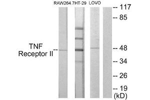 Western Blotting (WB) image for anti-Tumor Necrosis Factor Receptor Superfamily, Member 1B (TNFRSF1B) (C-Term) antibody (ABIN1849234)