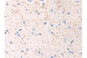 Detection of MAP2K1 in Human Cerebrum Tissue using Polyclonal Antibody to Mitogen Activated Protein Kinase Kinase 1 (MAP2K1)