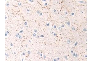 Detection of MAP2K1 in Human Cerebrum Tissue using Polyclonal Antibody to Mitogen Activated Protein Kinase Kinase 1 (MAP2K1) (MEK1 anticorps  (AA 54-369))