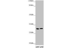 Western blot All lanes: SNAP29 antibody at 1. (SNAP29 anticorps  (AA 1-258))