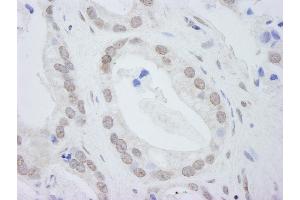 Immunohistochemistry (IHC) image for anti-DEAD (Asp-Glu-Ala-Asp) Box Polypeptide 24 (DDX24) (C-Term) antibody (ABIN7448518)