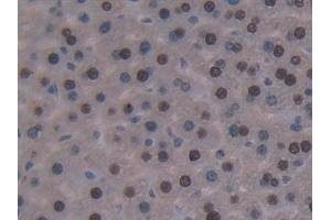 Detection of GKRP in Mouse Liver Tissue using Polyclonal Antibody to Glucokinase Regulatory Protein (GKRP)