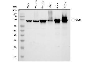 Western blot analysis of beta Catenin using anti-beta Catenin antibody (ABIN7601883).