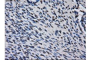 Immunohistochemical staining of paraffin-embedded colon tissue using anti-RPA2 mouse monoclonal antibody. (RPA2 anticorps)