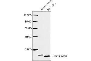 Western blot analysis of tissue lysates using 1 µg/mL Rabbit Anti-Parvalbumin Polyclonal Antibody (ABIN398923) The signal was developed with IRDye-800 Conjugated Goat Anti-Rabbit IgG. (PVALB anticorps)