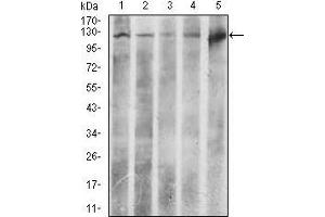 Western blot analysis using ACLY mouse mAb against HeLa (1), NIH3T3 (2), C6 (3), COS7 (4), and Raji (5) cell lysate.