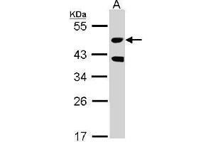 WB Image Sample (30 ug of whole cell lysate) A: Raji 10% SDS PAGE antibody diluted at 1:1000