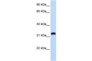 Western Blotting (WB) image for anti-Chromosome 21 Open Reading Frame 62 (C21orf62) antibody (ABIN2458967) (C21orf62 anticorps)