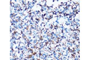 Immunohistochemistry of paraffin-embedded Human tonsil using SPN Polyclonal Antibody at dilution of 1:100 (40x lens).