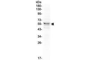 Western blot testing of human 293T cell lysate with LYN antibody at 0. (LYN anticorps  (AA 470-501))