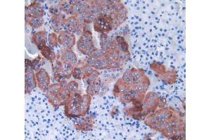 Used in DAB staining on fromalin fixed paraffin- embedded adrenal gland tissue (SHBG anticorps  (AA 44-222))