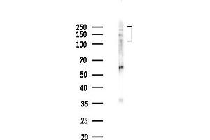Western blot analysis of lysates from K562 cells(UV,30 min treatment), using Phospho-IGF1 Receptor (Tyr1346) Antibody at 1/1000 dilution.