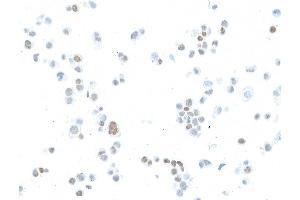 Immunocytochemistry (ICC) image for anti-Estrogen Receptor 1 (ESR1) antibody (ABIN7455134) (Estrogen Receptor alpha anticorps)
