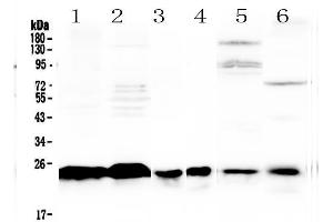 Western blot analysis of MED18 using anti-MED18 antibody . (MED18 anticorps  (AA 1-208))