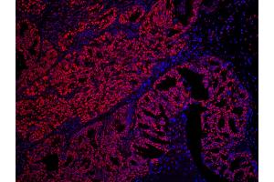 anti-SET Nuclear Oncogene (SET) (AA 125-175) antibody