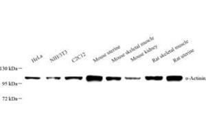 Western blot analysis of ACTN1 (ABIN7072905),at dilution of 1: 800 (ACTN1 anticorps)