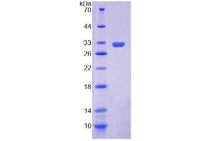 SDS-PAGE (SDS) image for Mitogen-Activated Protein Kinase Kinase Kinase 5 (MAP3K5) (AA 681-936) protein (His tag) (ABIN6240009)