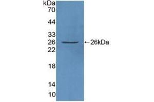 Detection of Recombinant FAM3C, Human using Polyclonal Antibody to Family With Sequence Similarity 3, Member C (FAM3C) (FAM3C anticorps  (AA 25-227))