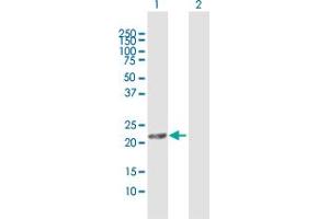 Western Blot analysis of MGC4172 expression in transfected 293T cell line by MGC4172 MaxPab polyclonal antibody. (DHRS11 anticorps  (AA 1-181))