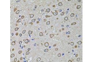 Immunohistochemistry of paraffin-embedded Rat brain using EIF4A2 Polyclonal Antibody at dilution of 1:100 (40x lens).