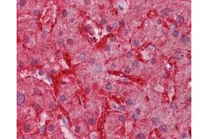 IHC testing of FFPE human liver tissue with Arginase 1 antibody at 3. (Liver Arginase anticorps)