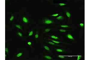 Immunofluorescence of purified MaxPab antibody to NEK3 on HeLa cell. (NEK3 anticorps  (AA 1-506))