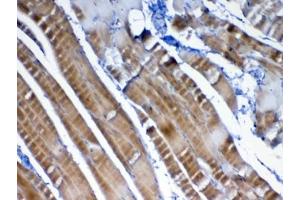 IHC testing of FFPE rat skeletal muscle tissue with VEGFB antibody at 1ug/ml. (VEGFB (VEGF2) anticorps)