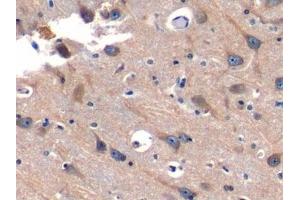Detection of SNUPN1 in Human Cerebrum Tissue using Polyclonal Antibody to Snurportin 1 (SNUPN1)