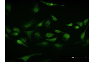 Immunofluorescence of purified MaxPab antibody to ELAVL1 on HeLa cell. (ELAVL1 anticorps  (AA 1-326))
