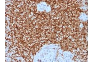IHC testing of FFPE human spleen tissue with recombinant Bcl2 antibody (clone BCL2/1878R). (Bcl-2 anticorps)