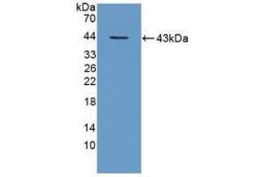 Detection of Recombinant TPP1, Mouse using Polyclonal Antibody to Tripeptidyl Peptidase I (TPP1) (TPP1 anticorps  (AA 198-562))