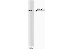 Western blot analysis of Stat6 on jurkat lysate. (STAT6 anticorps  (C-Term))