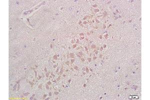 Formalin-fixed and paraffin embedded rat brain tissue labeled with Anti-Integrin beta 1/CD29 Polyclonal Antibody , Unconjugated at 1:200, followed by conjugation to the secondary antibody and DAB staining