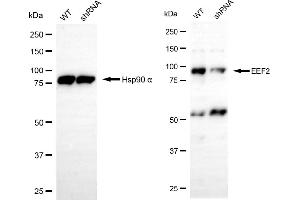 Western blotting analysis using EEF2 antibody (ABIN7798501).