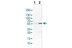 Western blot analysis of Lane 1: NIH/3T3 cell lysate and Lane 2: NBT-II cell lysate with LYN polyclonal antibody . (LYN anticorps  (AA 7-147))