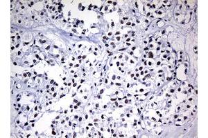 Image no. 6 for anti-Nibrin (NBN) (AA 183-460) antibody (ABIN1491059)