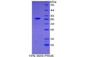 SDS-PAGE analysis of Human Nephronectin Protein. (Nephronectin Protein (NPNT))