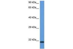 Image no. 1 for anti-CD70 Molecule (CD70) (AA 31-80) antibody (ABIN6747332) (CD70 anticorps  (AA 31-80))