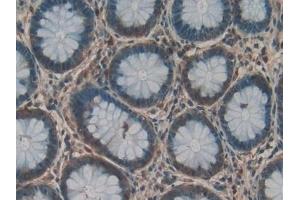 Detection of TFR2 in Human Rectum Tissue using Polyclonal Antibody to Transferrin Receptor 2 (TFR2)