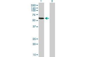 Western Blot analysis of RNF8 expression in transfected 293T cell line by RNF8 MaxPab polyclonal antibody. (RNF8 anticorps  (AA 1-485))