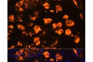 Immunofluorescence analysis of C6 cells using JAG2 Polyclonal Antibody at dilution of 1:100. (JAG2 anticorps)