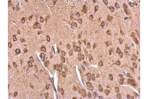 IHC-P Image EEF1A2 antibody detects EEF1A2 protein at cytosol on rat fore brain by immunohistochemical analysis. (EEF1A2 anticorps)