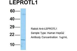 Host: Rabbit Target Name: LEPROTL1 Sample Type: Human HepG2 Antibody Dilution: 1. (LEPROTL1 anticorps  (N-Term))