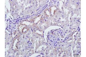 Paraformaldehyde-fixed, paraffin embedded rat kidney tissue, Antigen retrieval by boiling in sodium citrate buffer(pH6) for 15min, Block endogenous peroxidase by 3% hydrogen peroxide for 30 minutes, Blocking buffer (normal goat serum) at 37°C for 20min, Antibody incubation with Rabbit Anti-PERK Polyclonal Antibody, Unconjugated  at 1:500 overnight at 4°C, followed by a conjugated secondary and DAB staining