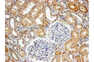 ABIN184613 (4µg/ml) staining of paraffin embedded Human Kidney. (WRNIP1 anticorps  (C-Term))