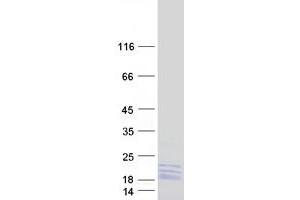 Validation with Western Blot