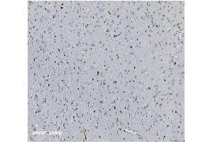 IHC analysis of Transketolase/TKT using anti-Transketolase/TKT antibody (ABIN7598959). (TKT anticorps  (AA 1-116))