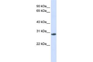 WB Suggested Anti-YIPF6 Antibody Titration:  0. (YIPF6 anticorps  (C-Term))