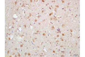 Formalin-fixed and paraffin embedded rat brain labeled with Rabbit Anti-AKT1/2/3 (Thr305/308/309) Polyclonal Antibody, Unconjugated (ABIN756052) at 1:200 followed by conjugation to the secondary antibody and DAB staining (AKT 1/2/3 anticorps  (pThr305, pThr308, pThr309))